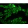 China Epi fluorescent microscope with LED light source for immunofluorescent wholesale