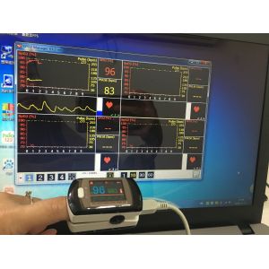 China Finger Oximete Wireless OLED USB Pulse Oximeter Blood Oxygen SPO2 / PR CMS50EW Bluetooth Oximete wholesale