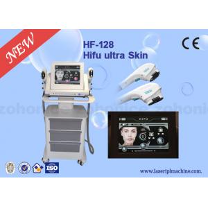50HZ / 60HZ High Intensity Focused sound Machine For Skin Tightening