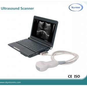 Desktop mode ultrasound scanner for cat and dog pregnancy