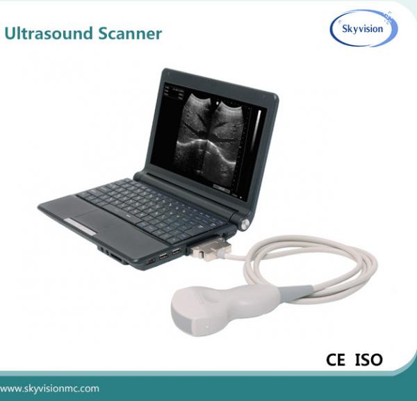 The most popular portable cheapest B/W ultrasound machine for pregnancy
