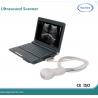 The most popular portable cheapest B/W ultrasound machine for pregnancy