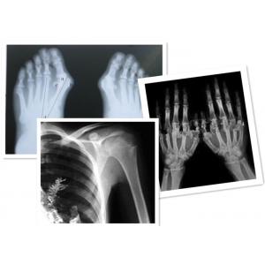 Thermal Digital X Ray Film Fuji Medical For Radiography Examination