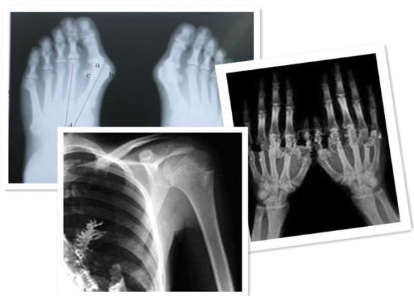 Thermal Digital X Ray Film Fuji Medical For Radiography Examination