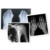 Thermal Digital X Ray Film Fuji Medical For Radiography Examination