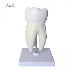 China Teeth Anatomical Model Molar Tooth Attach With Caries Maxillary 3 Roots Magnify supplier
