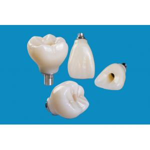Professional Zirconia Dental Implant Crown Titanium CAD CAM