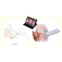 Healthcare Product Gynecological Endoscopic Digital Electronic Colposcope For Women Home Use
