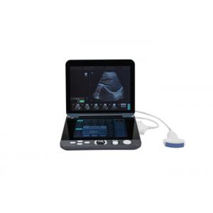 Digital Portable Mobile Laptop Ultrasound Scanner With 12-inch LED Display & 9.7-inch Touch Screen