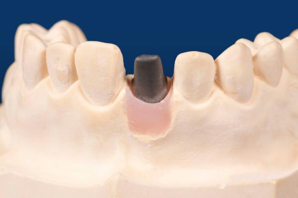 Sandblasted Titanium Custom Abutment Rectangular Implant Custom Abutment