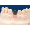 China Sandblasted Titanium Custom Abutment Rectangular Implant Custom Abutment wholesale