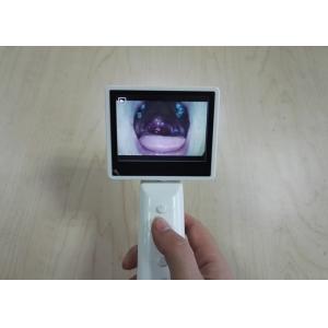 China SD Card Storage ENT Diagnostic Equipment Otoscope Ophthalmoscope Automatically With USB Cable supplier
