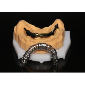 China Class 5 All On 4 AOX Implants With Hybrid Titanium Bar / Clips / Metal Mesh / for sale