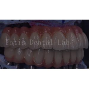 OEM Service Durable Dental Implant Temporary Crown Easy Maintenance