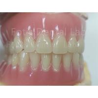 China Comfort Custom Fit Full Acrylic Denture For Precise Dental Prosthesis on sale