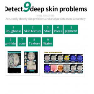 China High Definition Skin Home Analyzer 3d Function Digital Images 9kg Nw supplier