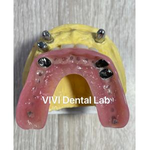 CAD CAM Tooth Partial Denture Attachment Dental Professional Accurate