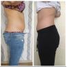Fat Freeze slimm best seller  5 heads cryolipolysis slimming lipolaser fat frezzing machine Cryo Handles can work at sam