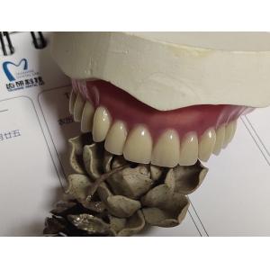 Complete Denture Permanent Esthetics Acrylic Partial Denture