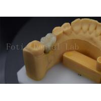 China Long Lasting Comfortable  Dental Implant Crowns For Restoration Of Missing Teeth on sale