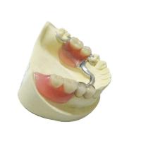 China Steel Removable Partial Dentures Denture Restoration Dental Lab Products on sale