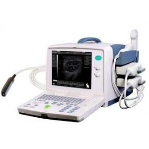 Full digital B mode ultrasonic diagnostic instrument SG3200