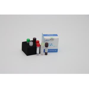 Laboratory Multiplex Fast Real Time RT PCR Detection Kit Reagents For Sars Virus Detection