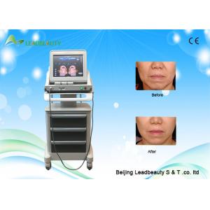 China Aesthetics and medical care HIFU face lifting skin tightening beauty machine supplier
