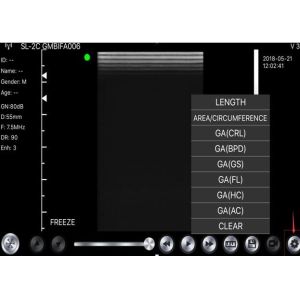 China Wireless Usb Ultrasound Scanner Linear Convex Phased 3 IN 1 on sale