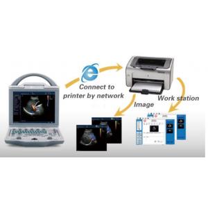 Full Digital Color Doppler Machine 2D Ultrasonic Diagnostic Scanner Device