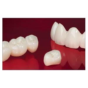 China Full / Solid Dental Zirconia Crowns Restorations With CAD / CAM of Dental Laboratory wholesale