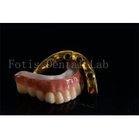 China Affordable All On Six Dental Implants Effective Treatment Easy To Clean on sale