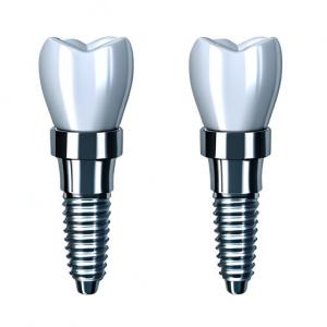 Consistency In Every Crown Our Dental Implant Crown Manufacturing Process