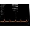 China Linear/Convex/Phased Array 3 in 1 Handheld USB Ultrasound Double Probes Wireless Color Doppler Scanner wholesale