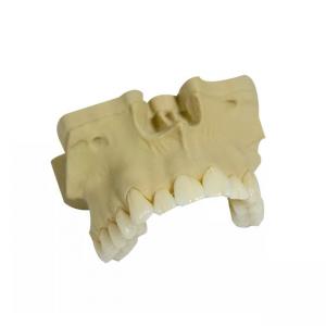 Smooth Surface PFM Dental Crown High Strength Realistic Appearance
