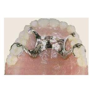 China Custom Tooth Shade of Removable Partial Dentures Dental Lab With Butter Retention wholesale