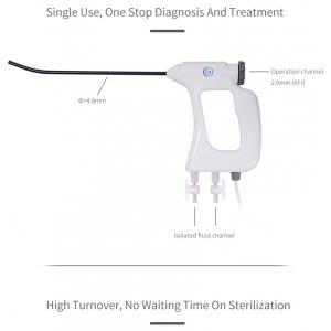 4.8mm Electronic Disposable Hysteroscopy Avoiding Cross Infection 100° View Angle