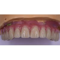 China Patient Comfort Custom Dental Crowns Polished Titanium/Zirconia/PFM Implant Crown on sale