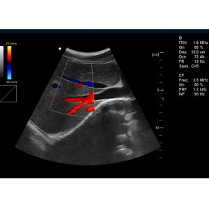 China Professional Color Doppler Machine Ultrasound Scanner Equipment With Software Packages supplier