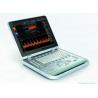 Ipad Ultrasonic Diagnostic Device Portable Ultrasound Scanner with 500G Image