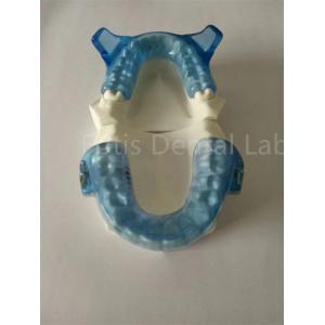Advanced Orthodontics Appliance For Superior Teeth Alignment Results