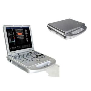 China GH-L5 Portable Ultrasound Machine  4d Diagnostic Ultrasound Pregnancy Machine supplier