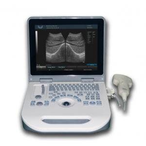 TGC Control Notebook Scanner Laptop Ultrasound Machine For Pregnancy Home