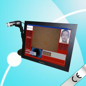 Portable Skin Analyzer Machine For Test Elasticity And Collagen Fibers