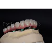 China Advanced Full Chewing Ability Restoration Implant Procedure for Low Bone Density Patients on sale