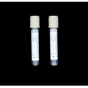 good price china supplier medical 2ml 5ml glucose vacuum blood collection tube