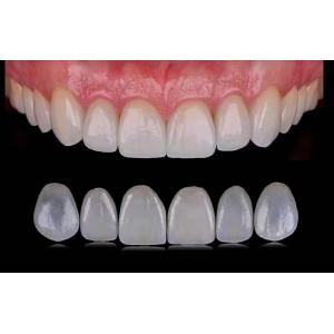 Tranlucent Emax Laminate Veneers / Porcelain Dental Veneers ISO Approved