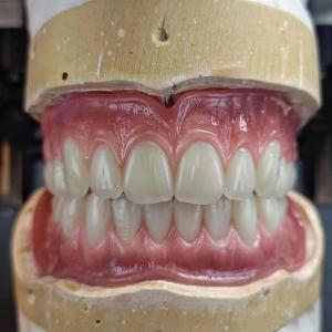 Dental Removable Complete Denture Ivoclar Full Denture Acrylic Teeth