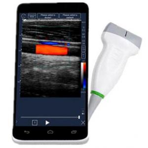 Mobile Full Digital Portable Ultrasound Machine Wireless With 6 Inch LCD Touch Screen