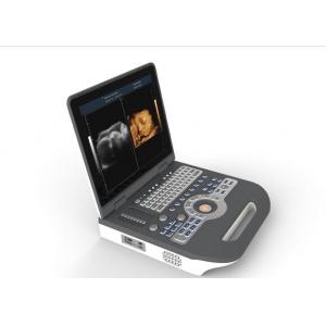 Medical Ultrasound Machine Portable Ultrasound Scanner 4d Ultrasound Equipment